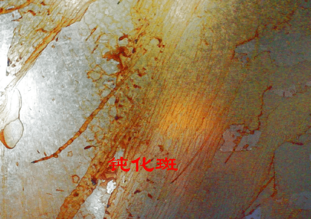 开云体育 Kaiyun.com 官网入口热镀锌 带钢 表面有缺陷怎么办？决措施有哪些？(图5)